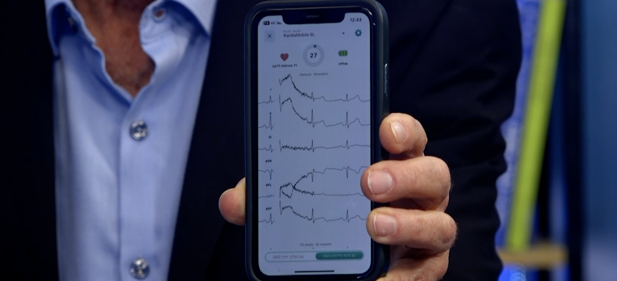 6 | מכשיר הקרדיה – למי הוא מתאים?